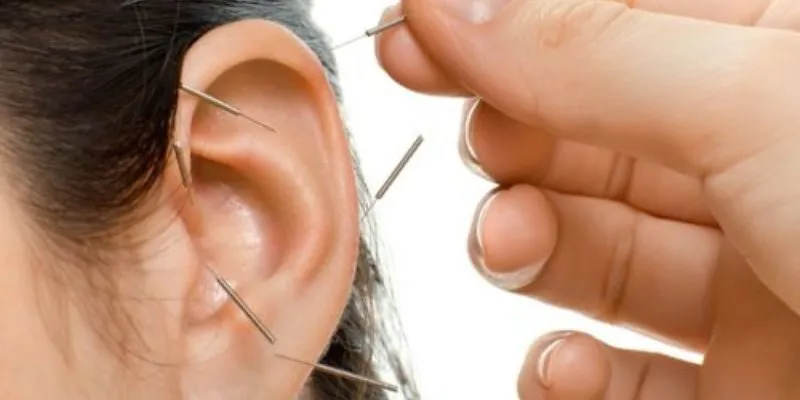 Điều trị chứng ù tai